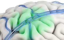 陈天桥抢先押注，脑机接口公司成功首秀苹果