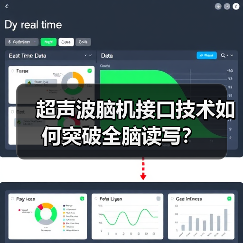 超声波脑机接口能否颠覆传统？格式塔科技如何实现全脑读写？-智穹界讯聚闻网
